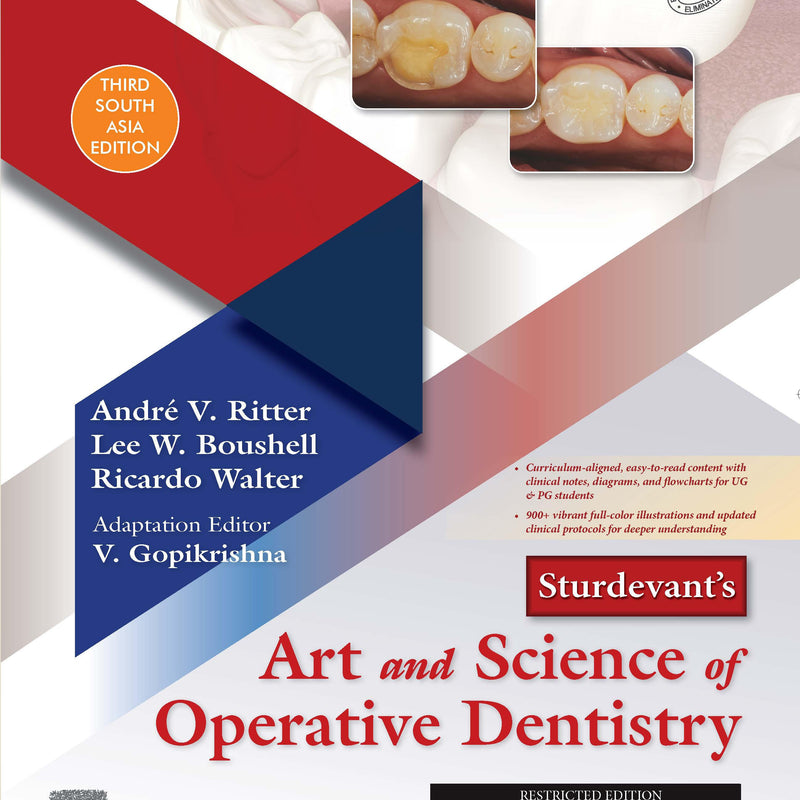 Sturdevant's Art and Science of Operative Dentistry: 3SAe, V Gopikrishna
