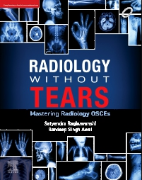 Radiology Without Tears Mastering Radiology OSCEs 1st/2024 by  Satyendra Raghuwanshi