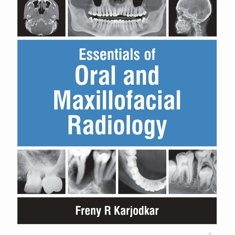 ESSENTIALS OF ORAL & MAXILLOFACIAL RADIOLOGY,3/E,FRENY R KARJODKAR