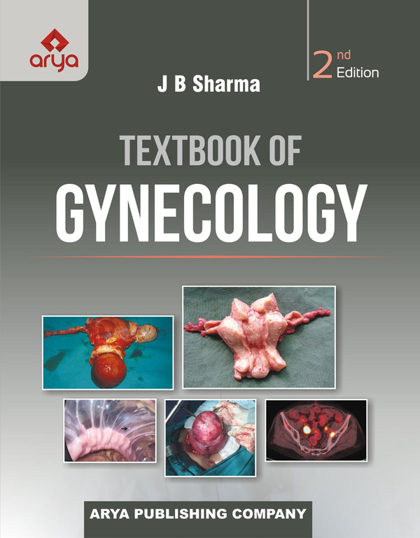 Textbook Of Gynecology 2nd Edition Reprint 2022 By Jb Sharma