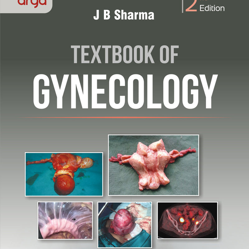 Textbook Of Gynecology 2nd Edition Reprint 2022 By Jb Sharma