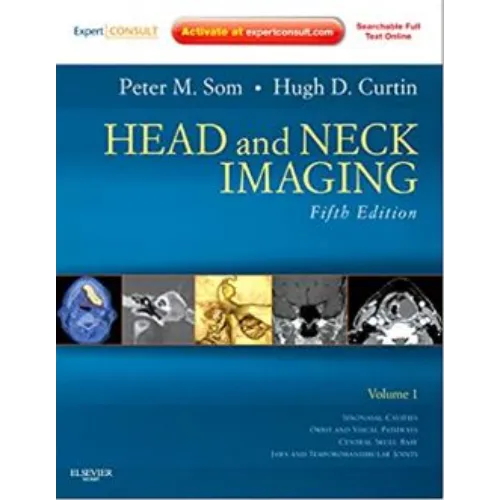 Head and Neck Imaging - 2 Volume Set:  Expert Consult- Online and Print, 5e by Som