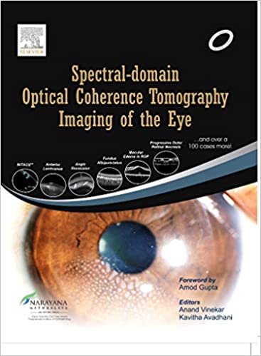 Spectral Domain Optical Coherence Tomography Imaging of the Eye, 1e by Vinekar