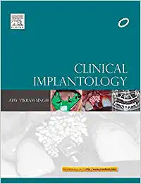 Clinical Implantology; E-Book also available, 1e by Vishram Singh