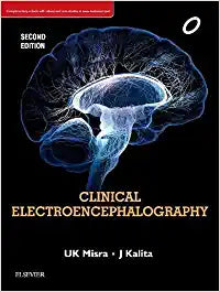 Clinical Electroencephalography, 2e by Misra