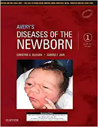 Avery's Diseases of the Newborn: First South Asia Edition by Gleason
