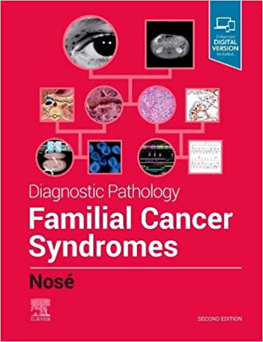 Diagnostic Pathology: Familial Cancer Syndromes, 2e by Nosé