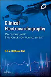 Clinical Electrocardiography, 1e by Rao