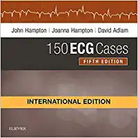 150 ECG Cases, International Edition, 5e by Hampton