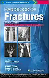 Handbook of Fracture, SAE by Egol/Thakur