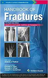 Handbook of Fracture, SAE by Egol/Thakur
