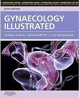 Gynaecology Illustrated, 6e by Bain