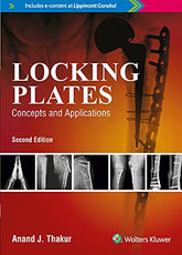 Locking Plates: Concepts and Applications, 2/e by Thakur