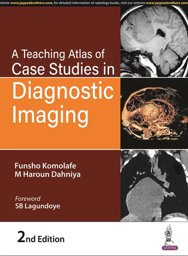 A Teaching Atlas Of Case Studies In Diagnostic Imaging 2nd Edition 2023 By Funsho Komolafe