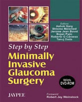 STEP BY STEP MINIMALLY INVASIVE GLAUCOMA SURGERY WITH DVD-ROM,1/E,ASHOK GARG