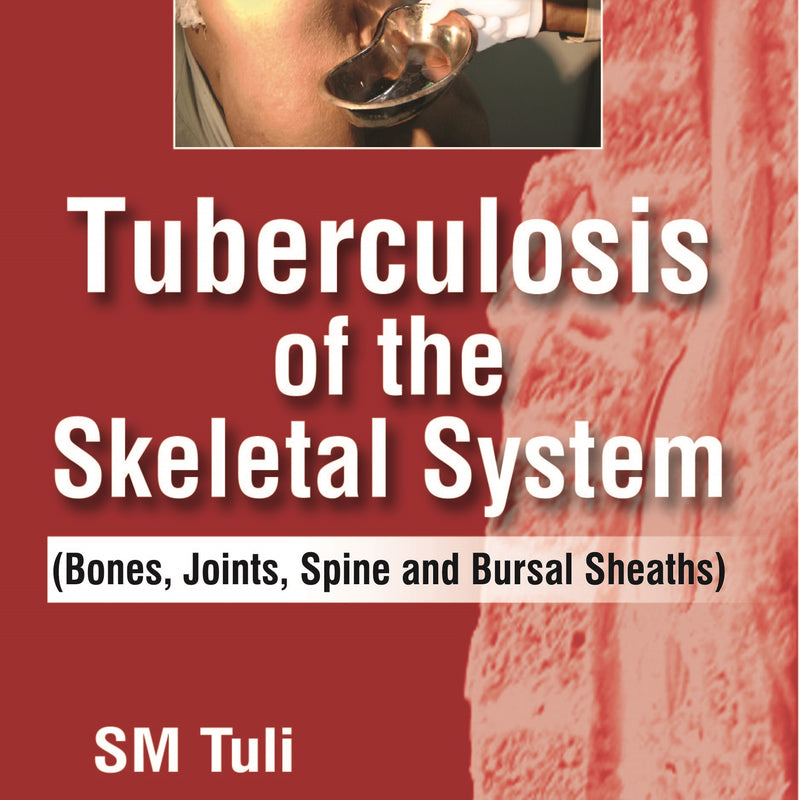 TUBERCULOSIS OF THE SKELETAL SYSTEM (BONES, JOINTS, SPINE AND BURSAL SHEATHS),6/E,SM TULI