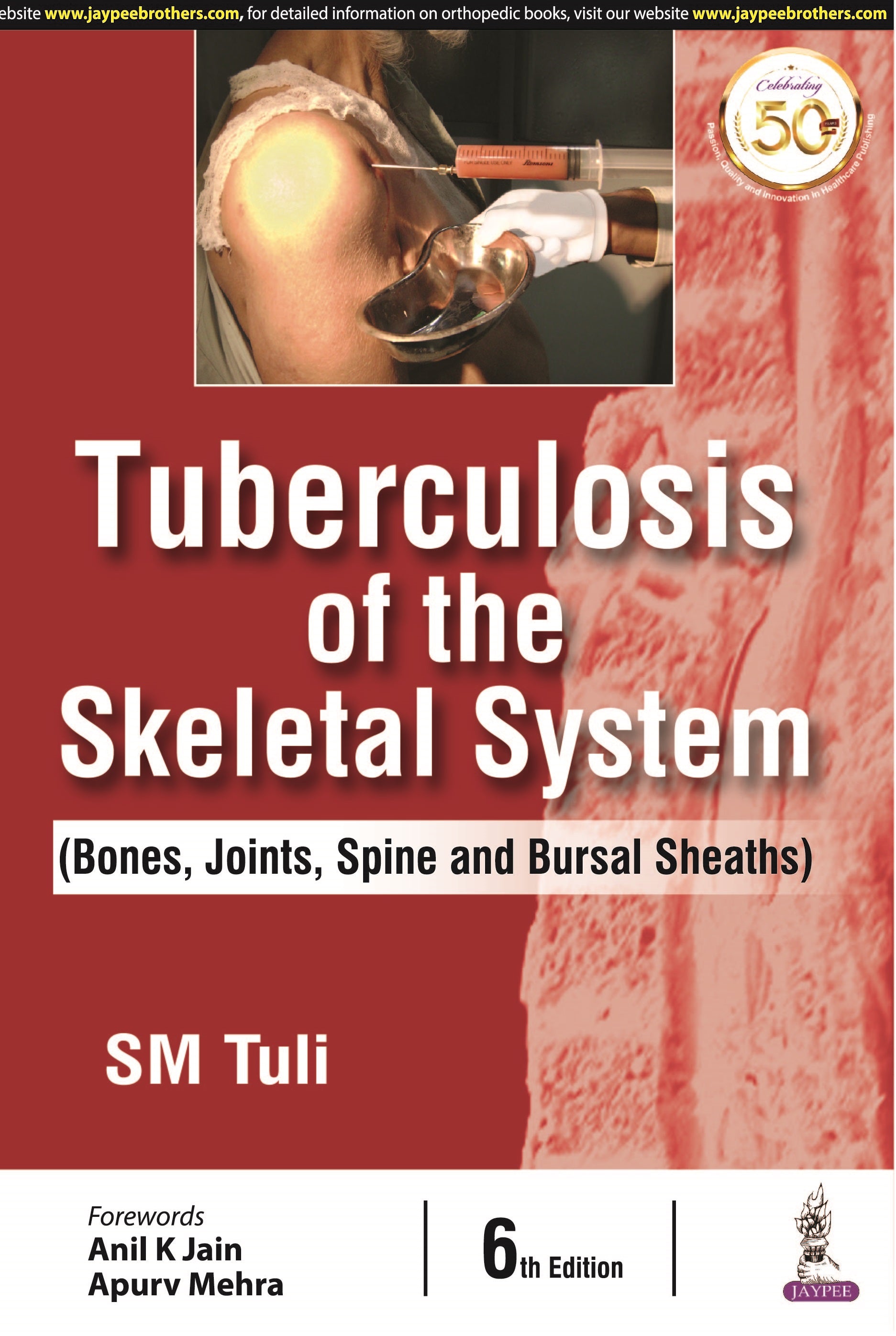 TUBERCULOSIS OF THE SKELETAL SYSTEM (BONES, JOINTS, SPINE AND BURSAL SHEATHS),6/E,SM TULI