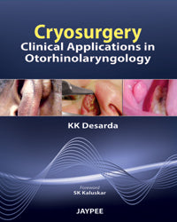 CRYOSURGERY: CLINICAL APPLICATIONS IN OTORHINOLARYNGOLOGY,1/E,DESARDA