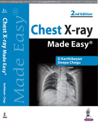 CHEST X-RAY MADE EASY,2/E,KARTHIKEYAN