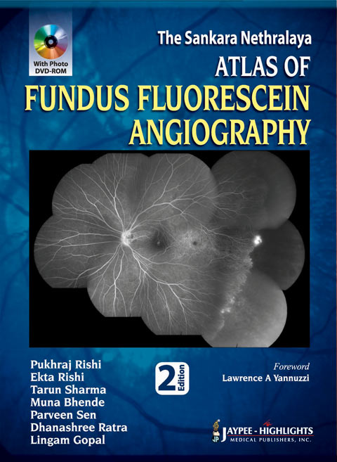 THE SANKARA NETHRALAYA ATLAS OF FUNDUS FLUORESCEIN ANGIOGRAPHY WITH PHOTO DVD-ROM,2/E,PUKHRAJ RISHI