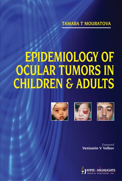 EPIDEMIOLOGY OF OCULAR TUMORS IN CHILDREN & ADULTS,1/E,MOURATOVA