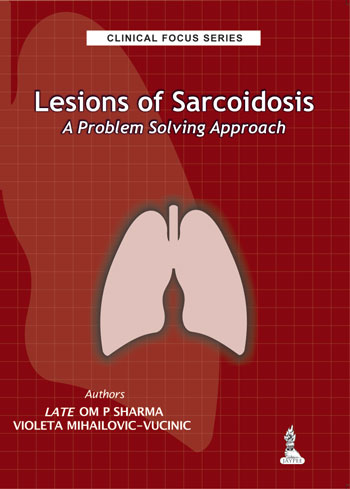 LESIONS OF SARCOIDOSIS A PROBLEM SOLVING APPROACH (CLINICAL FOCUS SERIES),1/E,OM P SHARMA