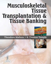 MUSCULOSKELETAL TISSUE TRANSPLANTATION & TISSUE BANKING,1/E,THEODORE MALININ