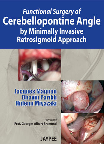 FUNCTIONAL SURGERY OF CEREBELLOPONTINE ANGLE BY MINIMALLY INVASIVE RETROSIGMOID APPROACH,1/E,JACQUES PARIKH MAGNAN