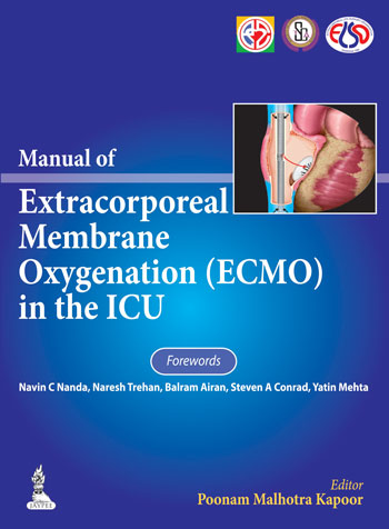 MANUAL OF EXTRACORPOREAL MEMBRANE OXYGENATION (ECMO) IN THE ICU,1/E,POONAM MALHOTRA KAPOOR