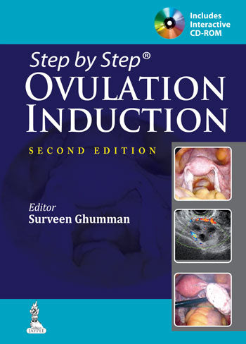 STEP BY STEP OVULATION INDUCTION WITH CD-ROM,2/E,SURVEEN GHUMMAN