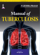 MANUAL OF TUBERCULOSIS,1/E,RAJENDRA PRASAD