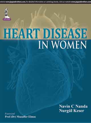 HEART DISEASE IN WOMEN,1/E,NAVIN C NANDA