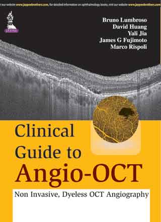 CLINICAL GUIDE TO ANGIO-OCT: NON INVASIVE,DYELESS OCT ANGIOGRAPHY,1/E,BRUNO LUMBROSO