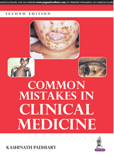 COMMON MISTAKES IN CLINICAL MEDICINE,2/E,KASHINATH PADHIARY