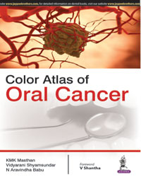 COLOR ATLAS OF ORAL CANCER,1/E,KMK MASTHAN