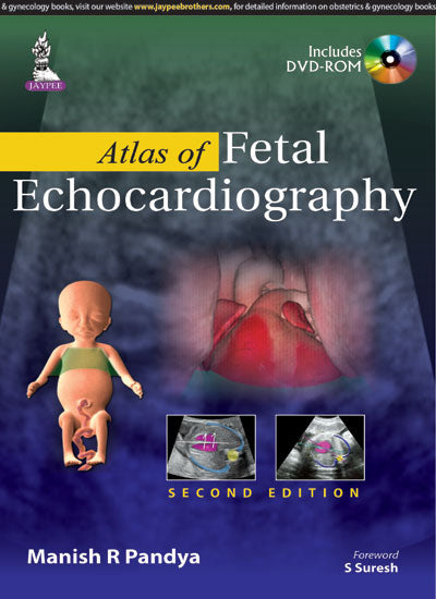 ATLAS OF FETAL ECHOCARDIOGRAPHY,2/E,MANISH R PANDYA