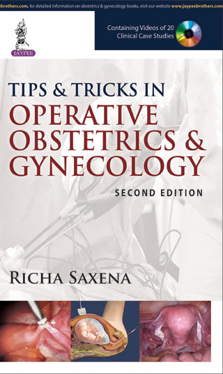TIPS & TRICKS IN OPERATIVE OBSTETRICS & GYNECOLOGY  WITH DVD ROM,2/E,RICHA SAXENA