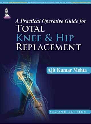 A PRACTICAL OPERATIVE GUIDE FOR TOTAL KNEE AND HIP REPLACEMENT,2/E,AJIT KUMAR MEHTA