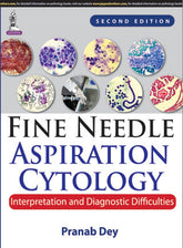 FINE NEEDLE ASPIRATION CYTOLOGY INTERPRETATION AND DIAGNOSTIC DIFFICULTIES,2/E,PRANAB DEY