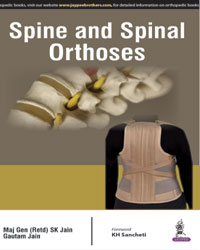 SPINE AND SPINAL ORTHOSES,1/E,SK JAIN