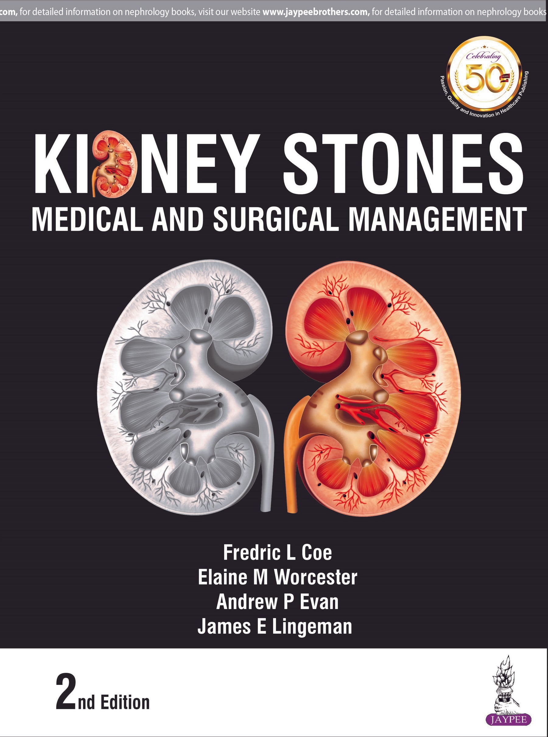 KIDNEY STONES: MEDICAL AND SURGICAL MANAGEMENT
,2/E,FREDRIC L COE