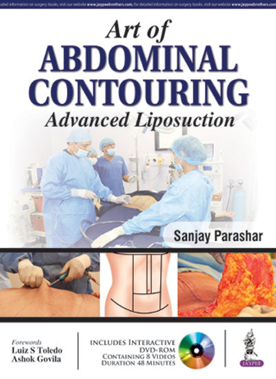 ART OF ABDOMINAL CONTOURING ADVANCED LIPOSUCTION WITH DVD-ROM,1/E,SANJAY PARASHAR