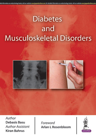 DIABETES AND MUSCULOSKELETAL DISORDERS,1/E,BASU