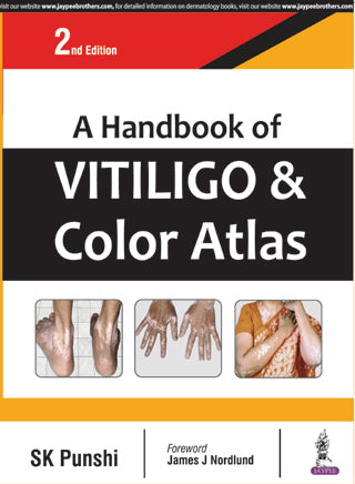 A HANDBOOK OF VITILIGO & COLOR ATLAS,2/E,SK PUNSHI