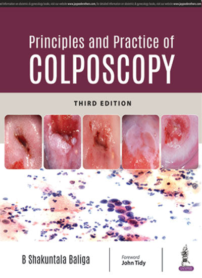 PRINCIPLES AND PRACTICE OF COLPOSCOPY,3/E,B SHAKUNTALA BALIGA