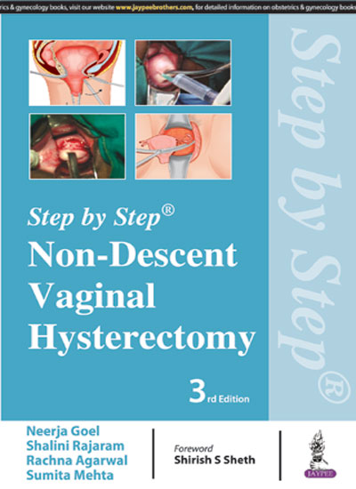 STEP BY STEP NON-DESCENT VAGINAL HYSTERECTOMY,3/E,NEERJA GOEL