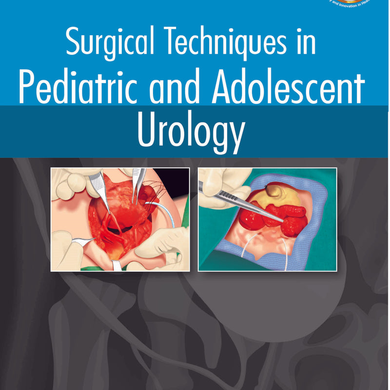 SURGICAL TECHNIQUES IN PEDIATRIC AND ADOLESCENT UROLOGY,1/E,MOHAN S GUNDETI