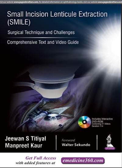 SMALL INCISION LENTICULE EXTRACTION (SMILE) SURGICAL TECHNIQUE AND CHALLENGES:COMPREHENSIVE TEXT,1/E,JEEWAN S TITIYAL