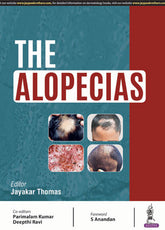 THE ALOPECIAS,1/E,JAYAKAR THOMAS