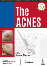 THE ACNES,1/E,JAYAKAR THOMAS